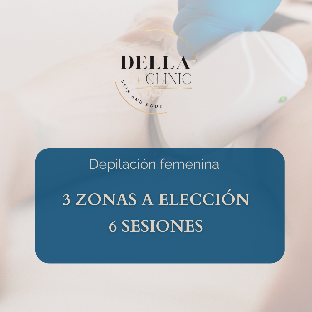 3 zonas a elección