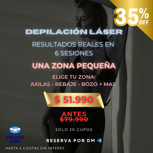 Una zona a elección